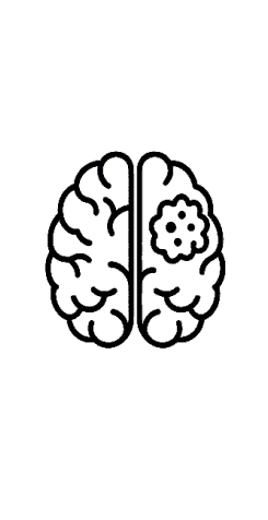 gbm