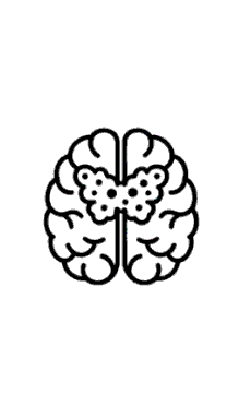 gbm